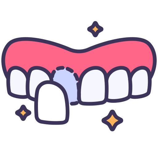 dental-veneer (1)